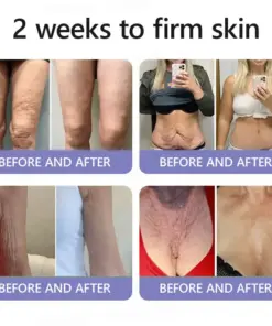 Turonu® Wrinkle-Reducing & Lifting Roller Cream
