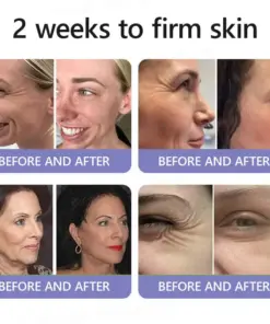 Turonu® Wrinkle-Reducing & Lifting Roller Cream