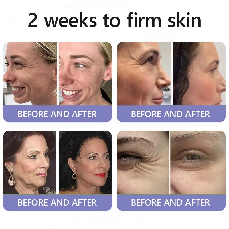 Turonu® Wrinkle-Reducing & Lifting Roller Cream