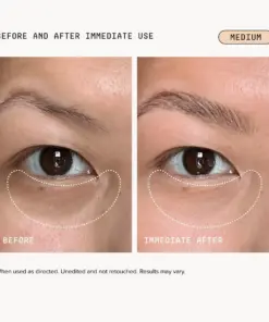 Turonu Brightening Eye Corrector