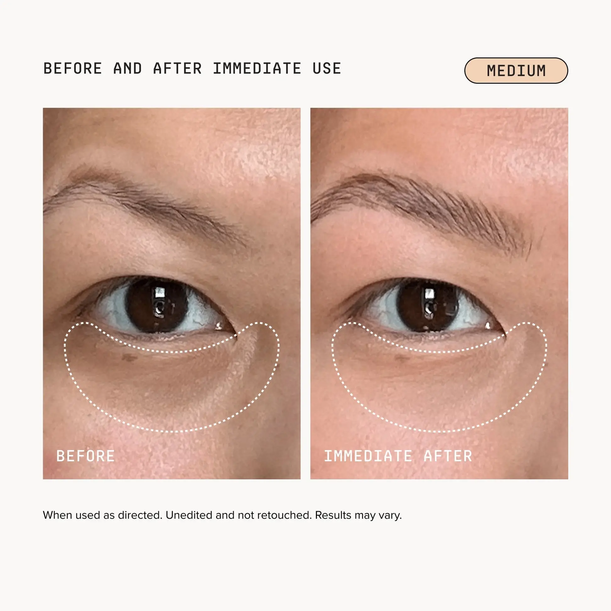 Turonu Brightening Eye Corrector