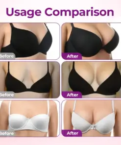 Turonu® Targeted Breast Enhancement Advanced Nano Microneedle Patch
