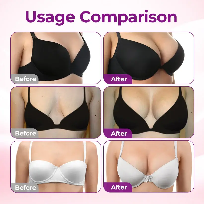 Turonu® Targeted Breast Enhancement Advanced Nano Microneedle Patch