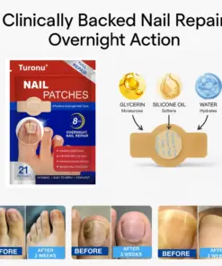 Turonu® Nail Repair Patches Overnight Hydrogel Care For Stronger-Looking Nails